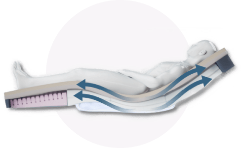 Forte Alaise Hybrid (Pumpless) Static Care Support Surface