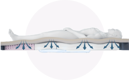 Forte Alaise Hybrid (Pumpless) Static Care Support Surface